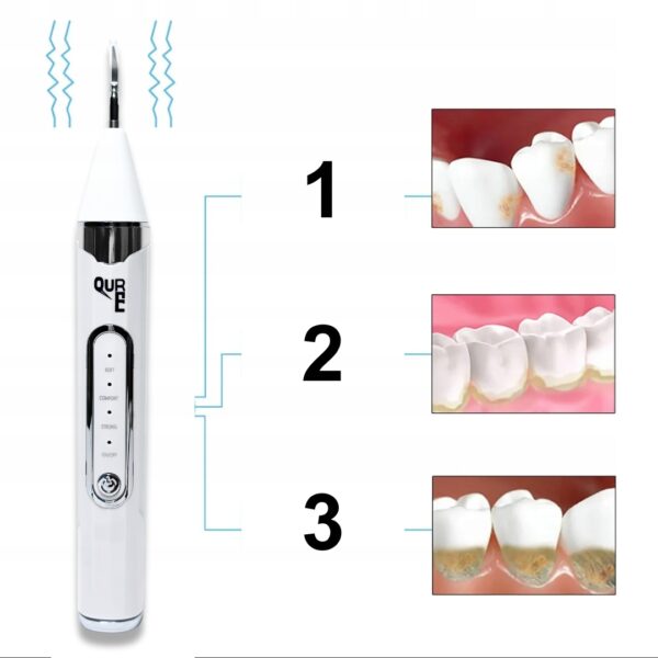 SKALER DENTYSTYCZNY QURE DO ZĘBÓW - obrazek 10